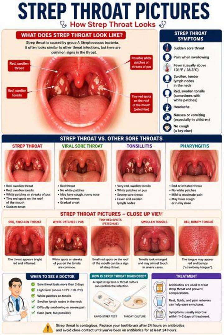 Does strep live in throat?