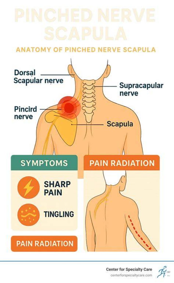 What are the symptoms of a pinched nerve in shoulder blade?