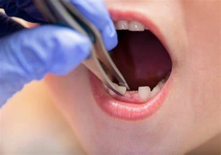 Why do I want to pull out my teeth?